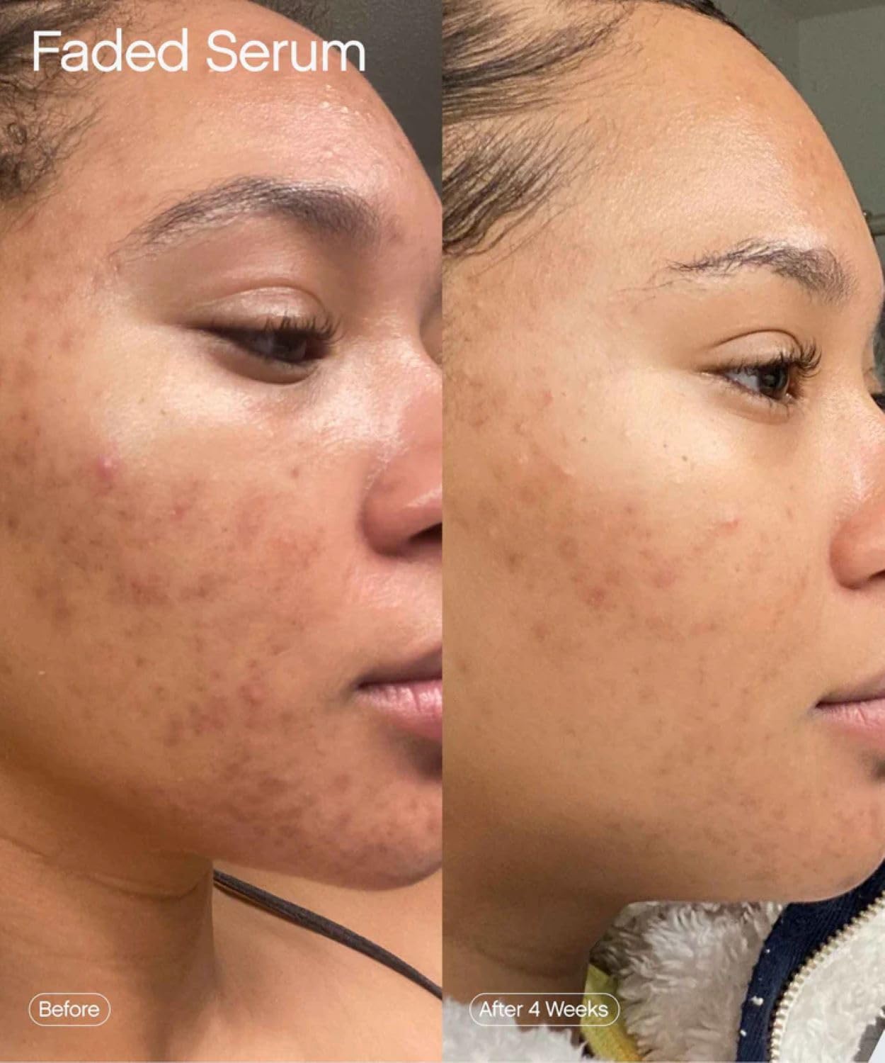 TOPICAL Faded Brightening and Clearing Serum