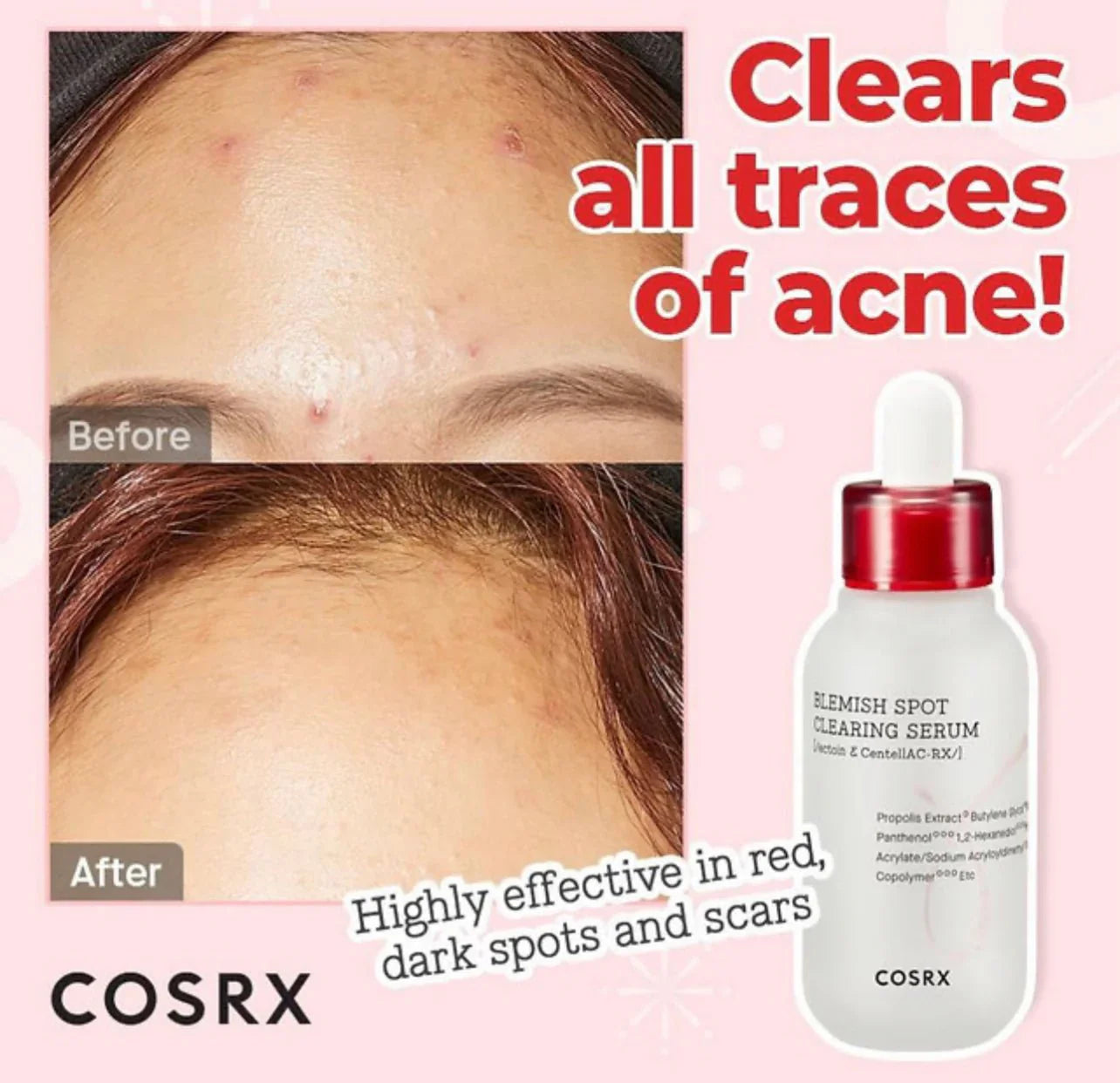 Cosrx Blemish Spot Clearing Serum 40ml