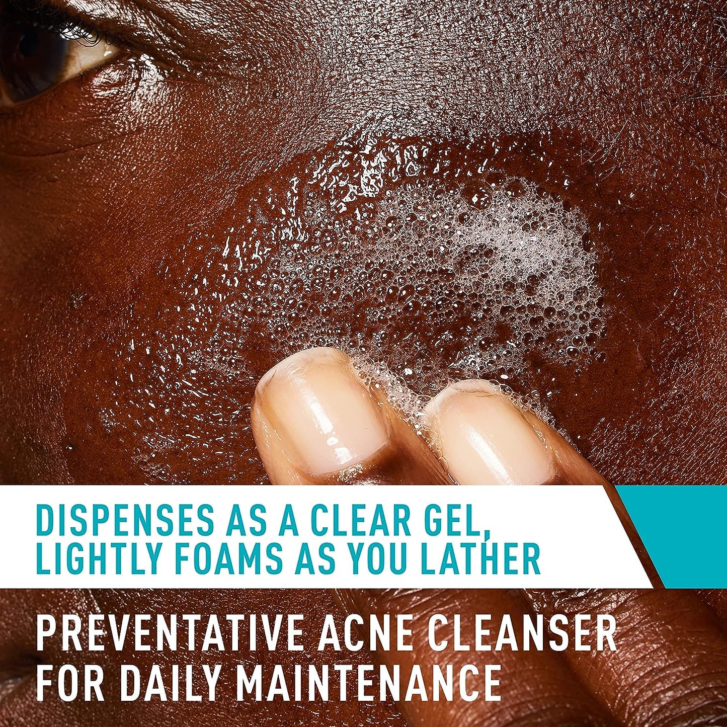 CeraVe Acne Control Cleanser 237ml