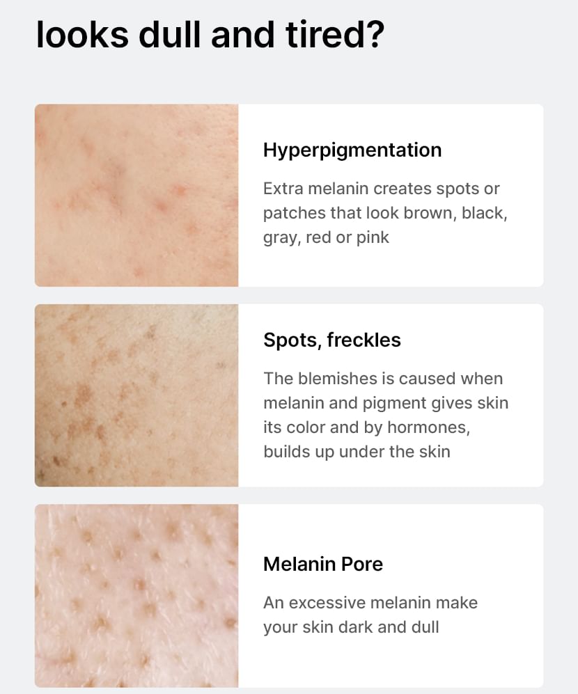 Celimax Pore + Dark Spot Brightening Serum 30ml