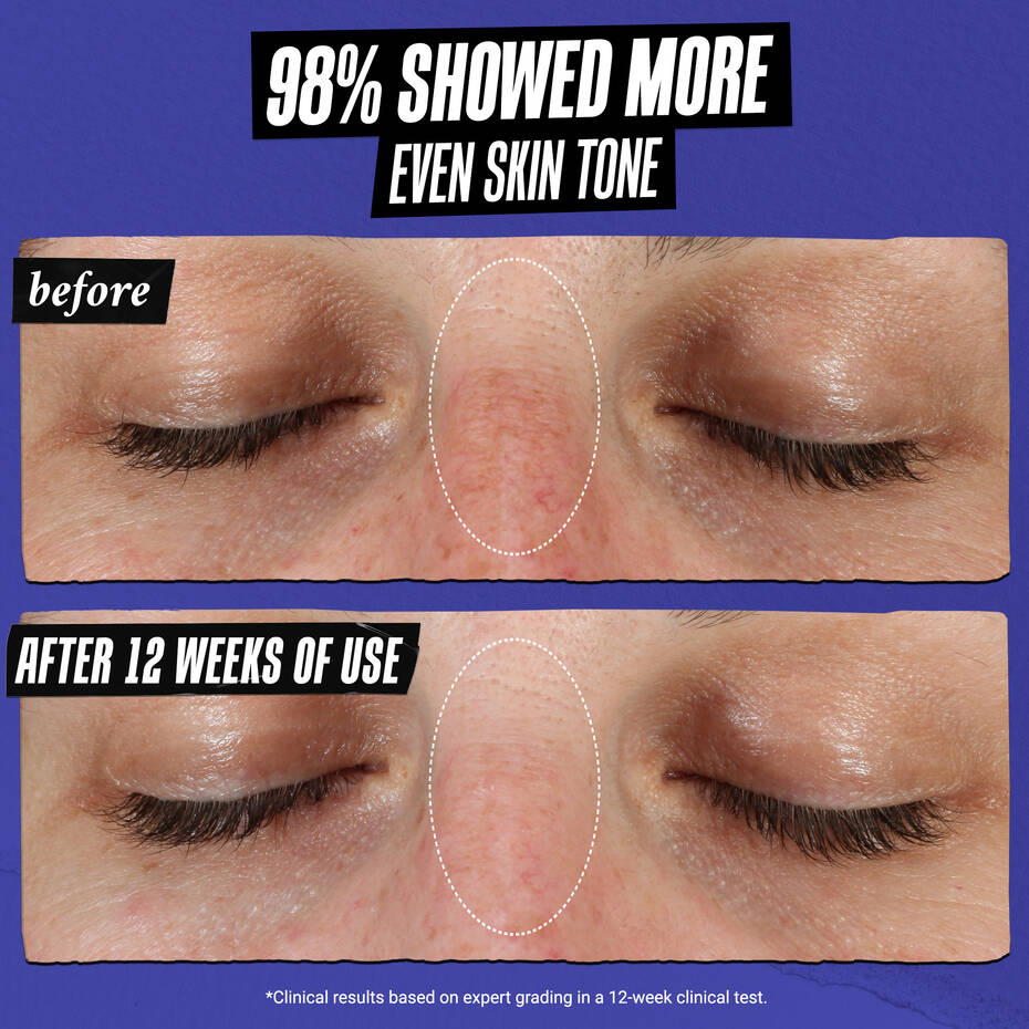 Clearly Corrective Dark Spot Serum